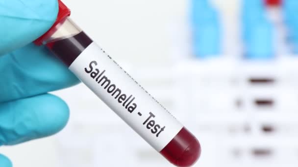 Тест Сальмонеллы Анализ Крови Лаборатории Кровь Пробирке — стоковое видео