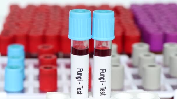 Test Dei Funghi Campione Sangue Analizzare Laboratorio Sangue Provetta — Video Stock