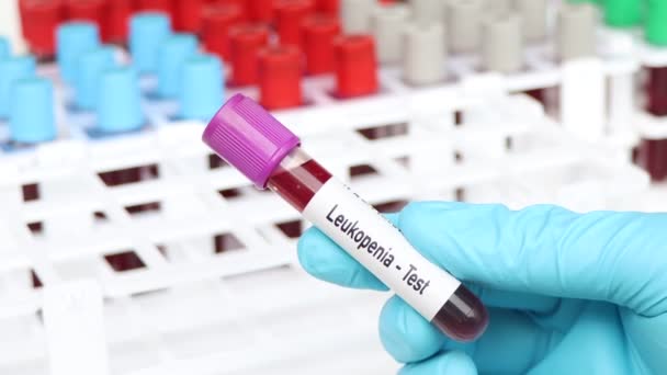 Leukopenie Test Bloedmonster Analyseren Het Laboratorium Bloed Reageerbuis — Stockvideo