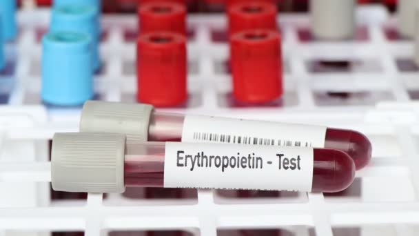 Erythropoietin Test Blutprobe Zur Analyse Labor Blut Reagenzglas — Stockvideo