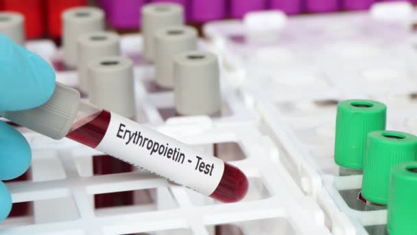 実験室で分析するためのエリスロポエチン検査 血液サンプル 試験管内の血液 — ストック動画