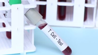 T hücresi - Test, laboratuvarda analiz edilecek kan örneği, test tüpünde kan.