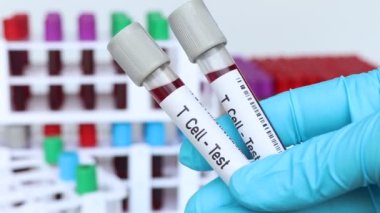 T hücresi - Test, laboratuvarda analiz edilecek kan örneği, test tüpünde kan.