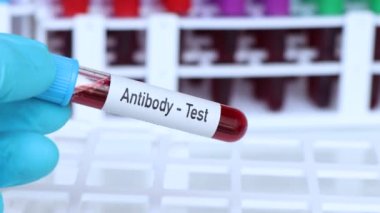 Antikor testi, laboratuvarda analiz edilecek kan örneği, test tüpünde kan.