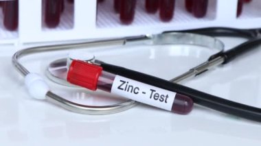 Çinko testi, laboratuvarda analiz edilecek kan örneği, test tüpünde kan.