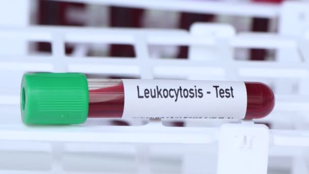Teste Leucocitose Amostra Sangue Para Analisar Laboratório Sangue Tubo Teste — Vídeo de Stock
