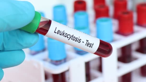 Prueba Leucocitosis Muestra Sangre Para Analizar Laboratorio Sangre Tubo Ensayo — Vídeo de stock