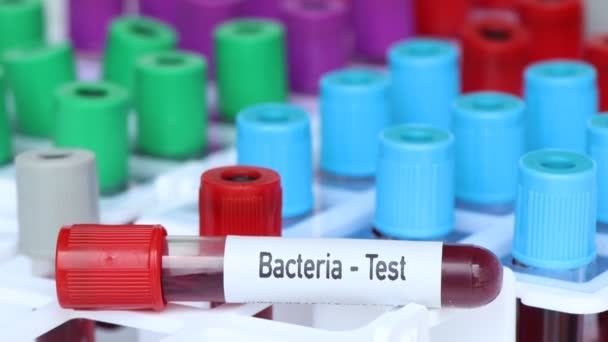Βακτήρια Δοκιμή Δείγμα Αίματος Για Ανάλυση Στο Εργαστήριο Αίμα Δοκιμαστικό — Αρχείο Βίντεο