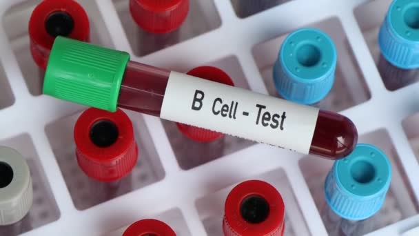 Sejt Teszt Vérminta Analizálni Laboratóriumban Vér Kémcsőben — Stock videók