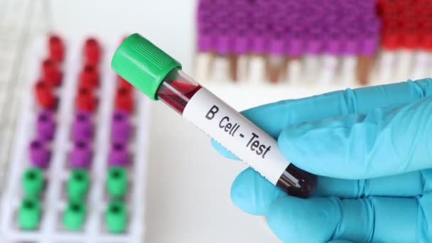 B细胞试验 在实验室进行血样分析 在试管中进行血液分析 — 图库视频影像