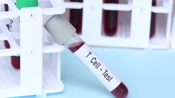 Cell Δοκιμή Δείγμα Αίματος Για Ανάλυση Στο Εργαστήριο Αίμα Δοκιμαστικό — Αρχείο Βίντεο