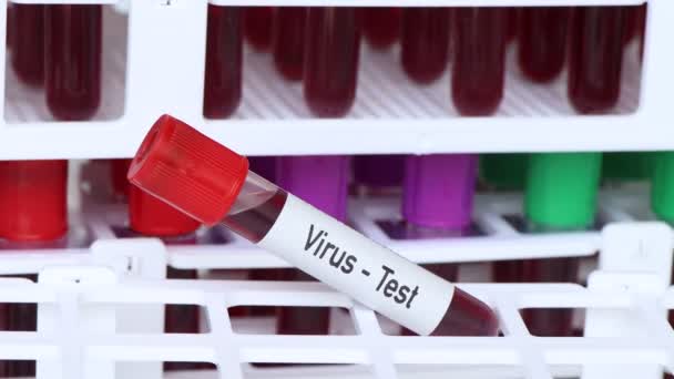 Prueba Virus Muestra Sangre Para Analizar Laboratorio Sangre Tubo Ensayo — Vídeo de stock