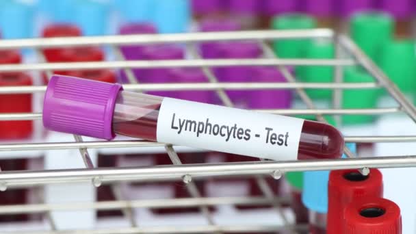 Lymphocyták Teszt Vérminta Analizálni Laboratóriumban Vér Kémcsőben — Stock videók