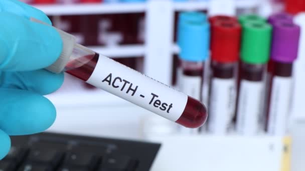 Тест Acth Анализ Крови Лаборатории Кровь Пробирке — стоковое видео