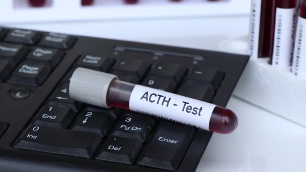 Teste Acth Amostra Sangue Para Analisar Laboratório Sangue Tubo Teste — Vídeo de Stock