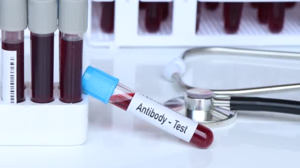 Τεστ Αντισωμάτων Δείγμα Αίματος Για Ανάλυση Στο Εργαστήριο Αίμα Δοκιμαστικό — Αρχείο Βίντεο