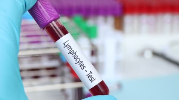 Lenfosit Testi Laboratuvarda Analiz Edilecek Kan Örneği Test Tüpünde Kan — Stok video