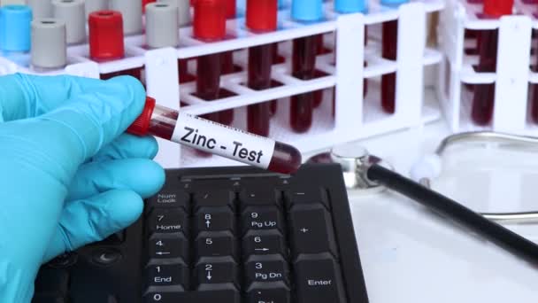 Test Dello Zinco Campione Sangue Analizzare Laboratorio Sangue Provetta — Video Stock