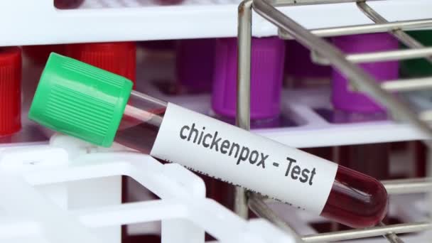 Suçiçeği Testi Laboratuvarda Analiz Edilecek Kan Örneği Test Tüpünde Kan — Stok video