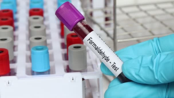 Τεστ Φορμαλδεΰδης Δείγμα Αίματος Για Ανάλυση Στο Εργαστήριο Αίμα Δοκιμαστικό — Αρχείο Βίντεο
