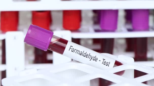 Formaldehit Testi Laboratuvarda Analiz Edilecek Kan Örneği Test Tüpünde Kan — Stok video