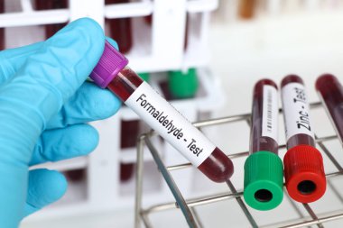 Formaldehit testi, laboratuvarda analiz edilecek kan örneği, test tüpünde kan.
