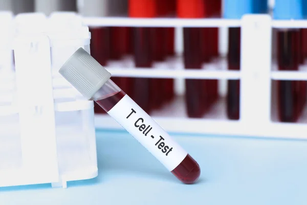Cell Prueba Muestra Sangre Para Analizar Laboratorio Sangre Tubo Ensayo — Foto de Stock
