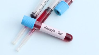 Monosit testi, laboratuvarda analiz edilecek kan örneği, test tüpünde kan.