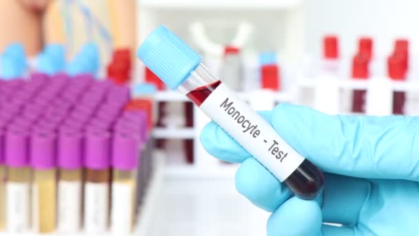 Teste Monócitos Amostra Sangue Para Analisar Laboratório Sangue Tubo Teste — Vídeo de Stock