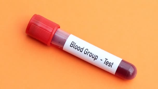 Análisis Grupo Sanguíneo Muestra Sangre Para Analizar Laboratorio Sangre Tubo — Vídeo de stock