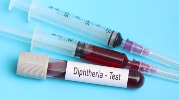 Záškrtový Test Vzorek Krve Analýze Laboratoři Krev Zkumavce — Stock video