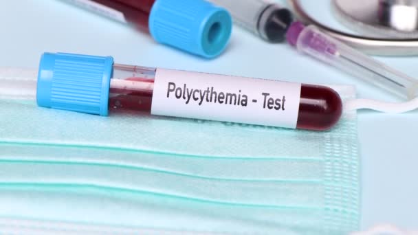 Τεστ Πολυκυττάρωσης Δείγμα Αίματος Για Ανάλυση Στο Εργαστήριο Αίμα Δοκιμαστικό — Αρχείο Βίντεο