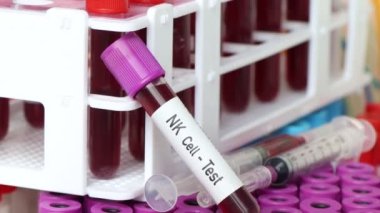 NK hücre testi, laboratuvarda analiz edilecek kan örneği, test tüpünde kan.