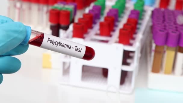 Teste Policitemia Amostra Sangue Para Analisar Laboratório Sangue Tubo Teste — Vídeo de Stock