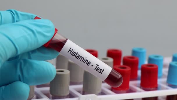Δοκιμή Ισταμίνης Δείγμα Αίματος Για Ανάλυση Στο Εργαστήριο Αίμα Δοκιμαστικό — Αρχείο Βίντεο