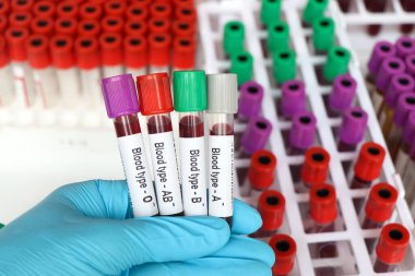Kan grubu Rh negatif test, laboratuvarda analiz edilecek kan örneği, test tüpünde kan.