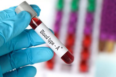 Kan grubu A Rh pozitif, laboratuarda analiz edilecek kan örneği, test tüpünde kan.