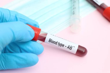 Kan grubu AB Rh negatif test, laboratuvarda analiz edilecek kan örneği, test tüpünde kan.