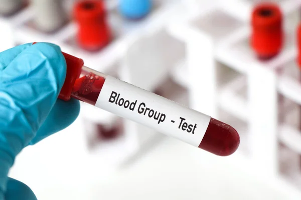 Análisis Grupo Sanguíneo Muestra Sangre Para Analizar Laboratorio Sangre Tubo — Foto de Stock