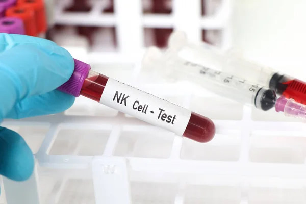 Prueba Células Muestra Sangre Para Analizar Laboratorio Sangre Tubo Ensayo — Foto de Stock
