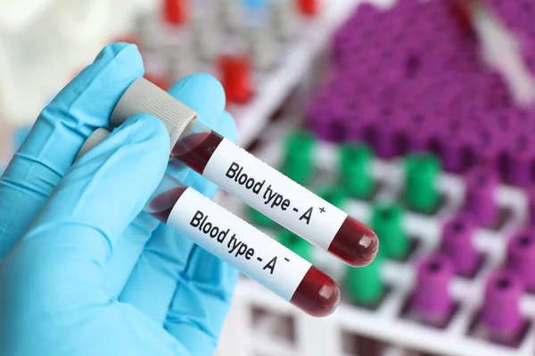 Análisis Sangre Tipo Positivo Negativo Muestra Sangre Para Analizar Laboratorio — Foto de Stock