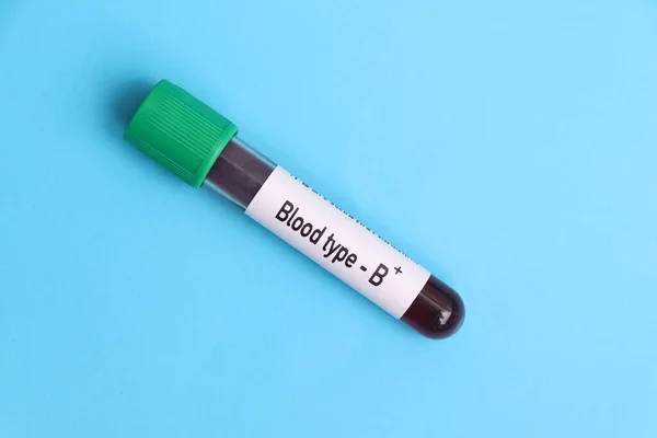 Grupa Krwi Dodatni Test Próbka Krwi Analizy Laboratorium Krew Probówce — Zdjęcie stockowe