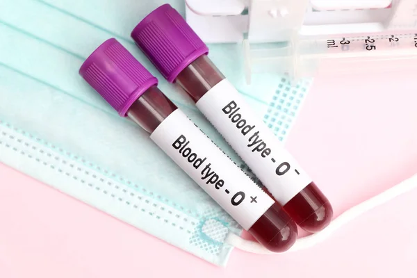 Blood type O Rh positive and negative test, blood sample to analyze in the laboratory, blood in test tube