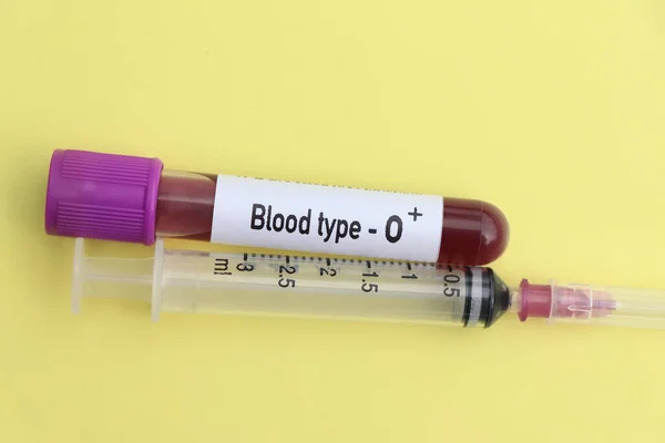 Grupa Krwi Próbka Krwi Analizy Laboratorium Krew Probówce — Zdjęcie stockowe