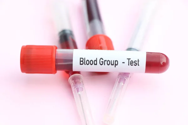 Blood Group Test Blood Sample Analyze Laboratory Blood Test Tube Stock Picture