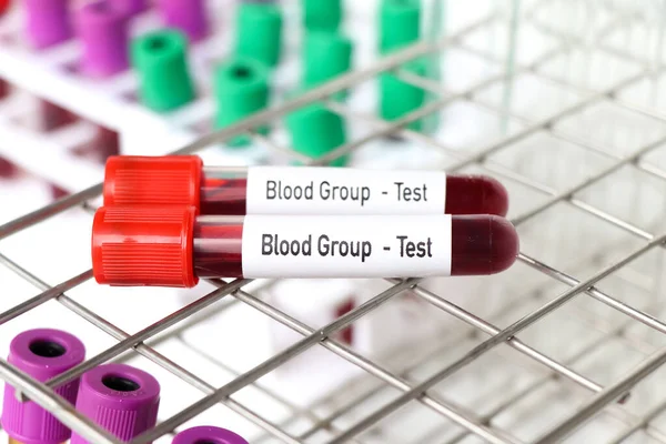 Blood Group Test Blood Sample Analyze Laboratory Blood Test Tube Royalty Free Stock Images
