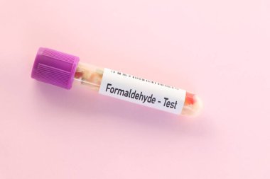 Formaldehit testi, laboratuvarda analiz edilecek yiyecek örneği, test tüpünde yiyecek.