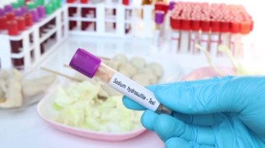 Sodyum hidrosülfit, laboratuarda analiz edilecek yiyecek örneği, test tüpünde yiyecek.