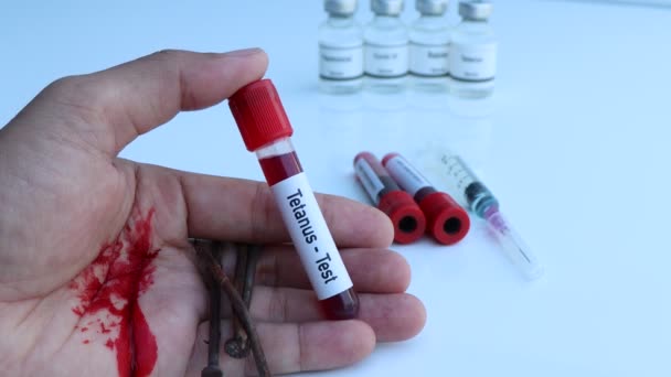 Prueba Del Tétanos Para Buscar Anomalías Sangre Experimento Científico — Vídeos de Stock