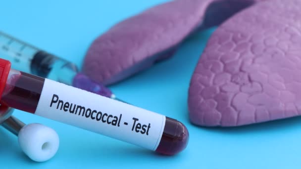 Pneumococcus Teszt Vér Rendellenességeinek Kimutatására Tudományos Kísérlet — Stock videók